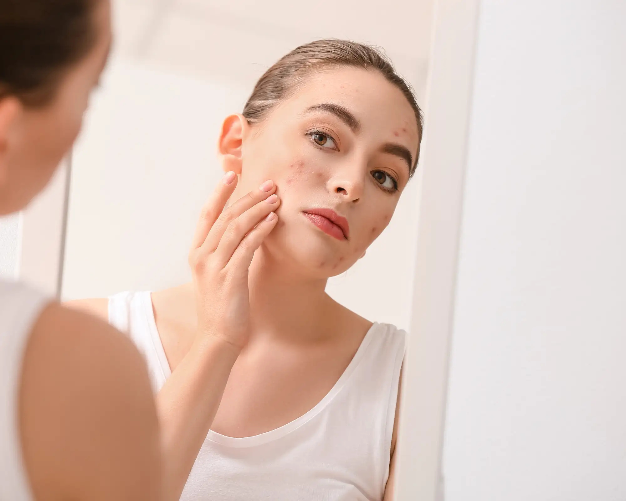 Ακμή και ευαισθησία μαζί; 1 Λύση με 3 βήματα - Femme Fatale - - Αν έχεις δοκιμάσει τα πάντα – και κάθε φορά το δέρμα σου αντιδρά – τότε το πρόβλημα πιθανότατα δεν είναι η λιπαρότητα, αλλά η διαταραγμένη ισορροπία του δέρματος Ακμή και ευαισθησία μαζί; 1 Λύση με 3 βήματα - Femme Fatale - Ακμή και ευαισθησία μαζί; 1 Λύση με 3 βήματα